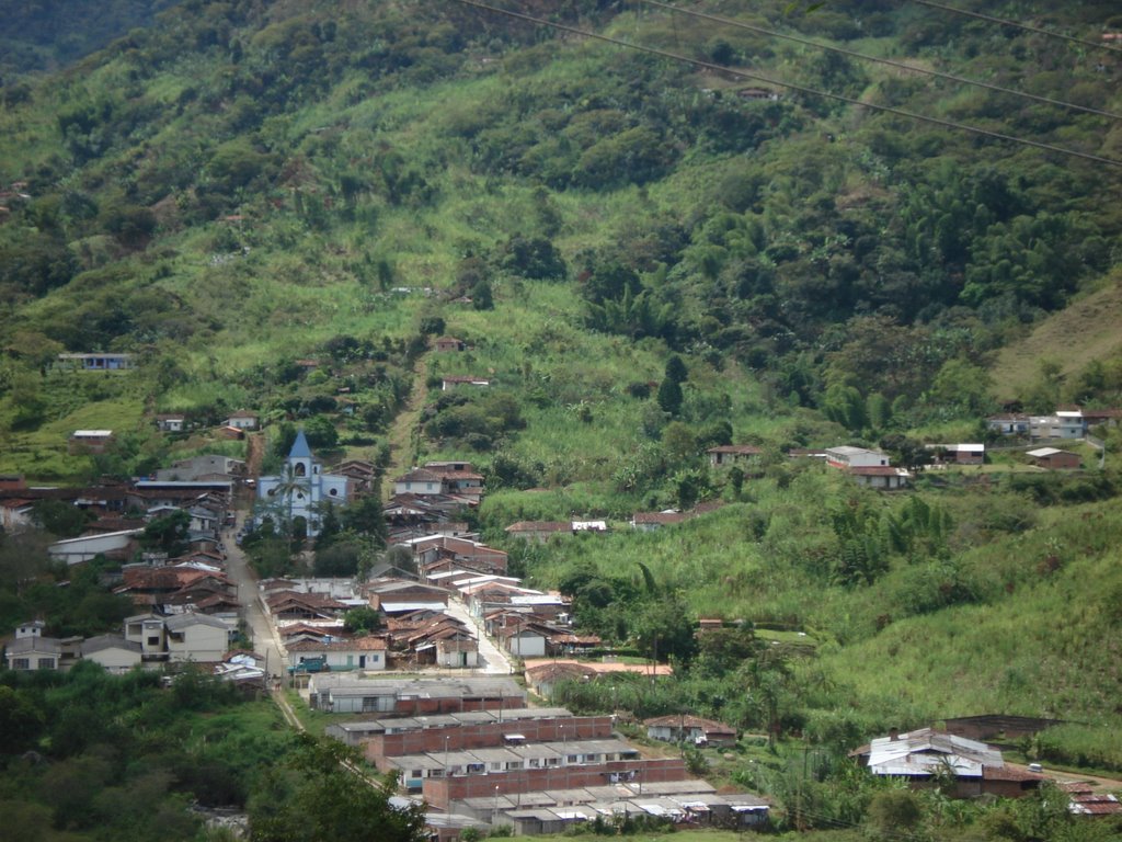 Se prenden las alarmas por brote de varicela en colegio de San Lorenzo